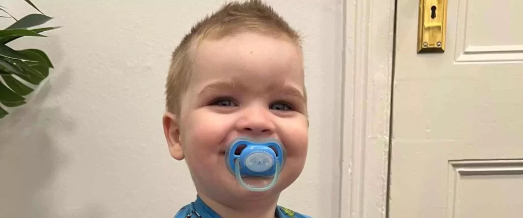 Little boy with Sagittal synostosis