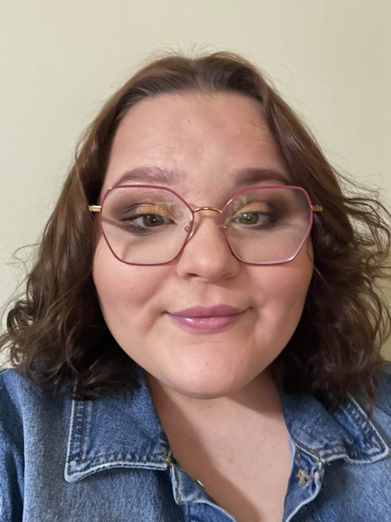 Young woman who was born with haemangioma