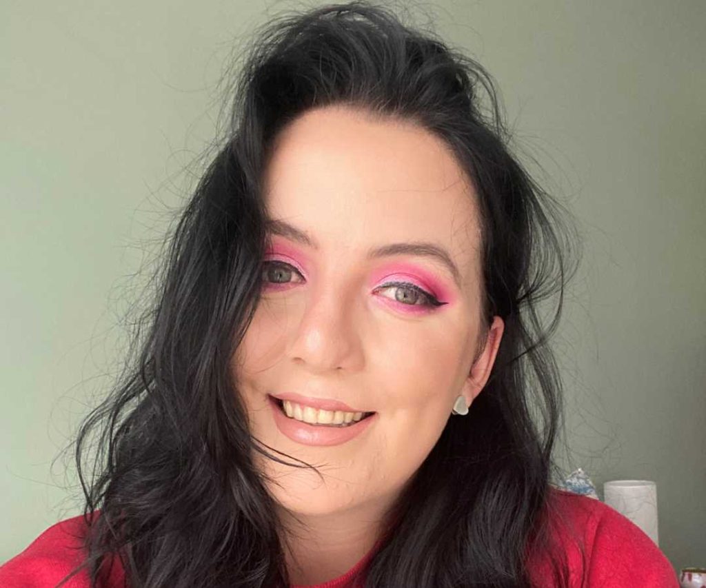 Woman who was born with cleft lip and palate
