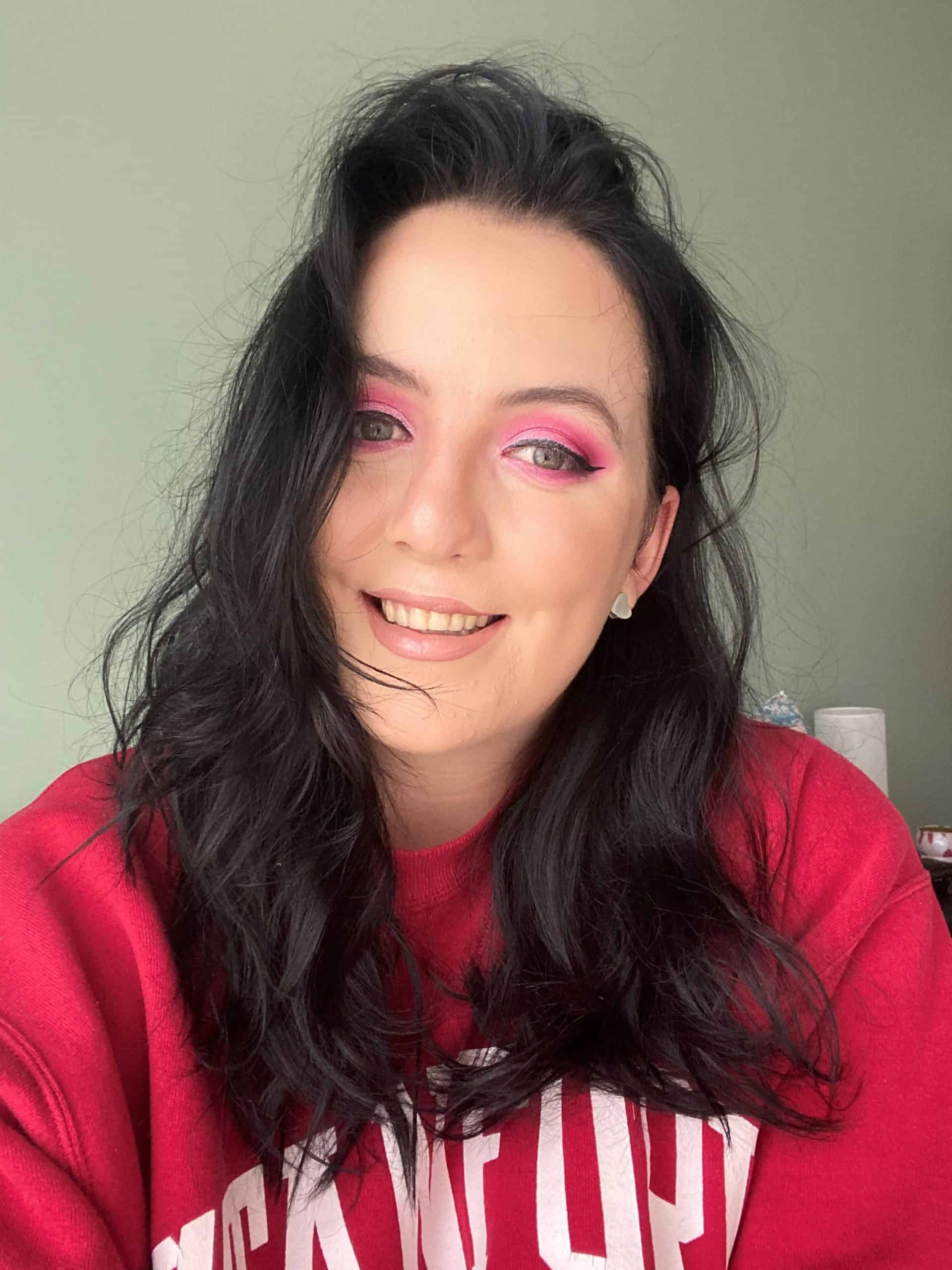 Woman who was born with cleft lip and palate and had surgical treatment as a child