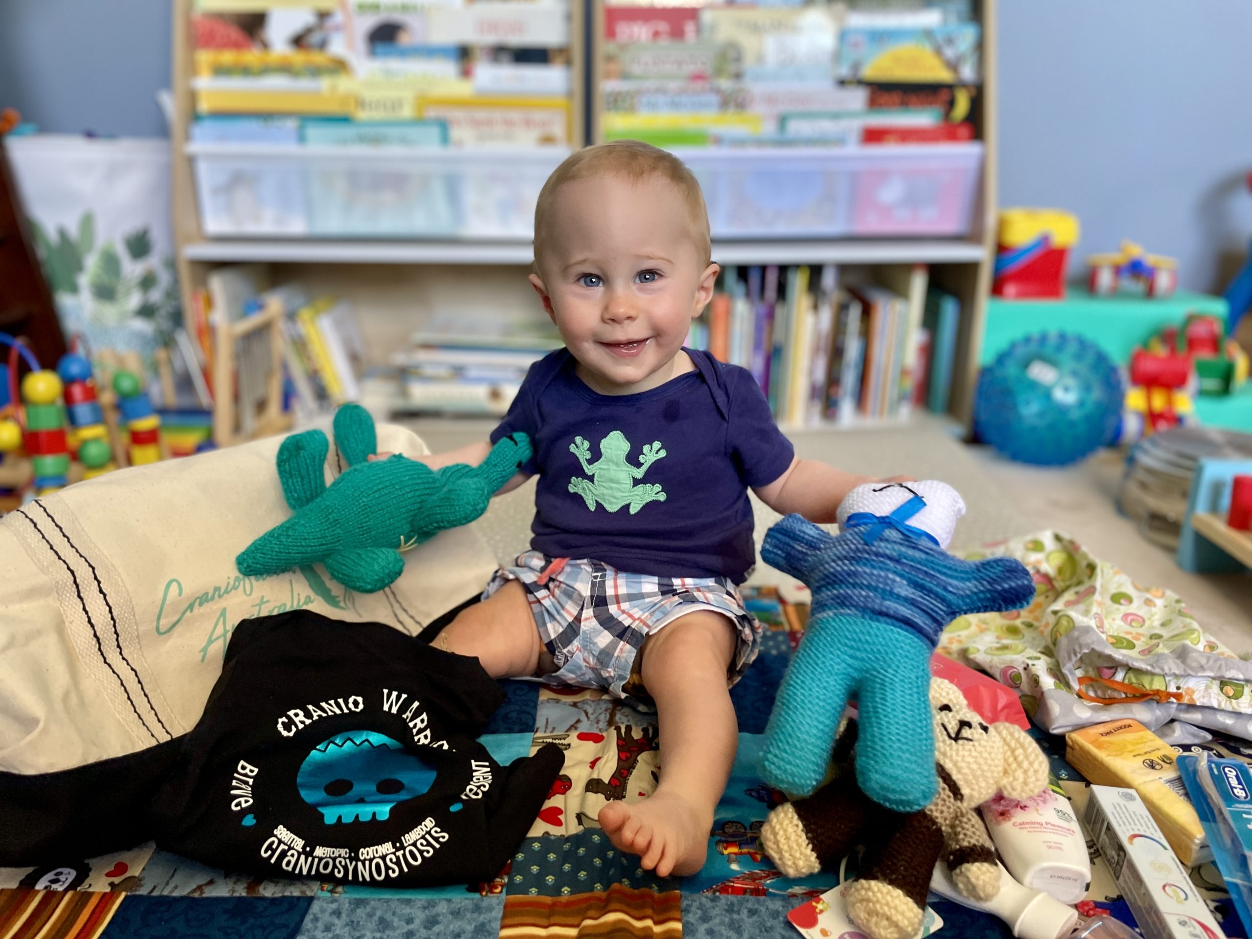 Baby with craniosynostosis surrounded by Craniofacial Australia care pack materials, wearing a Cranio Warrior t-shirt