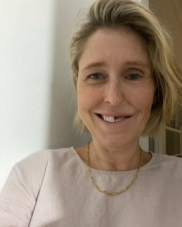 Woman who had surgery for facial tumour