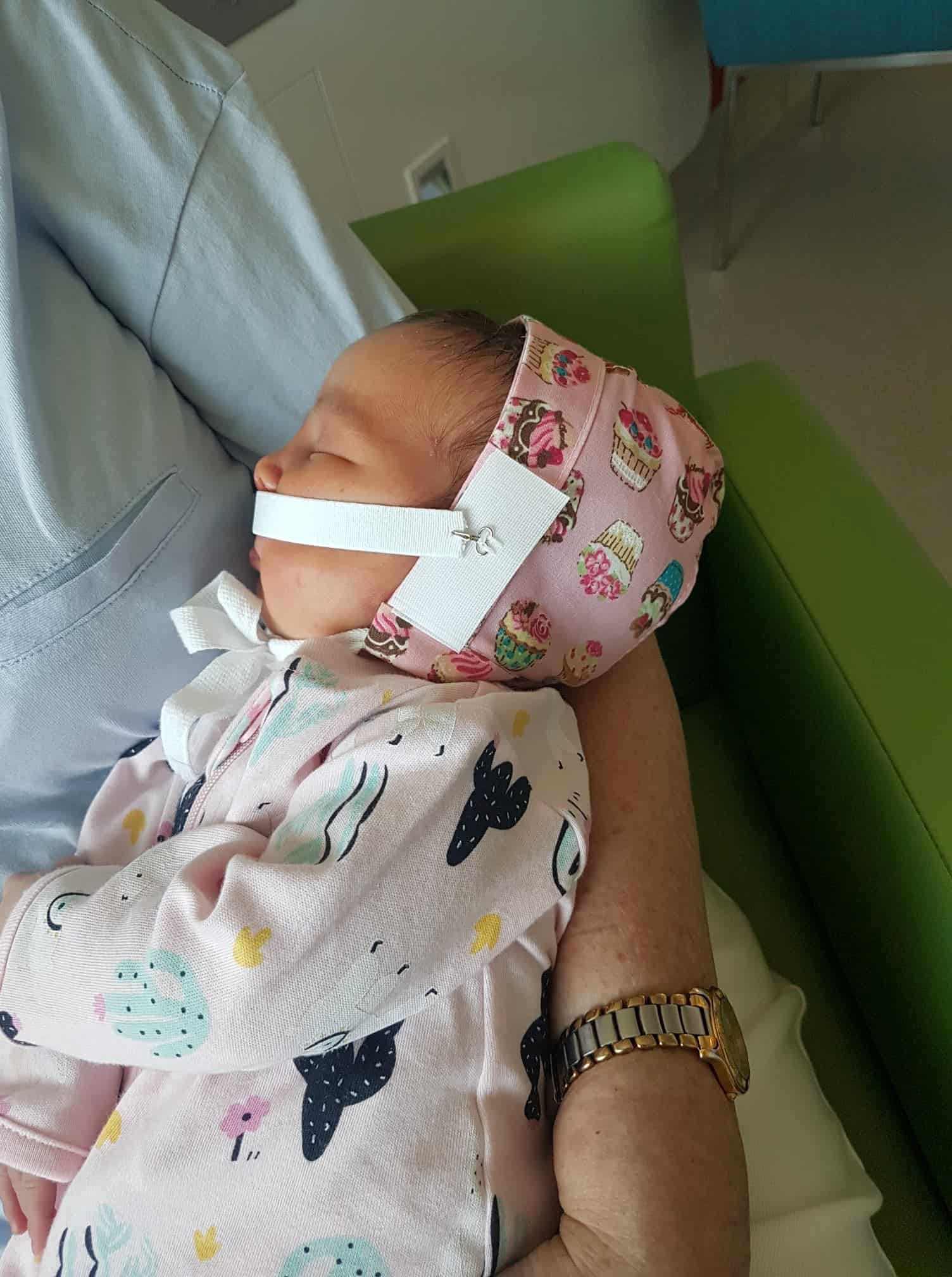 Baby with cleft lip and palate with bandage supporting face