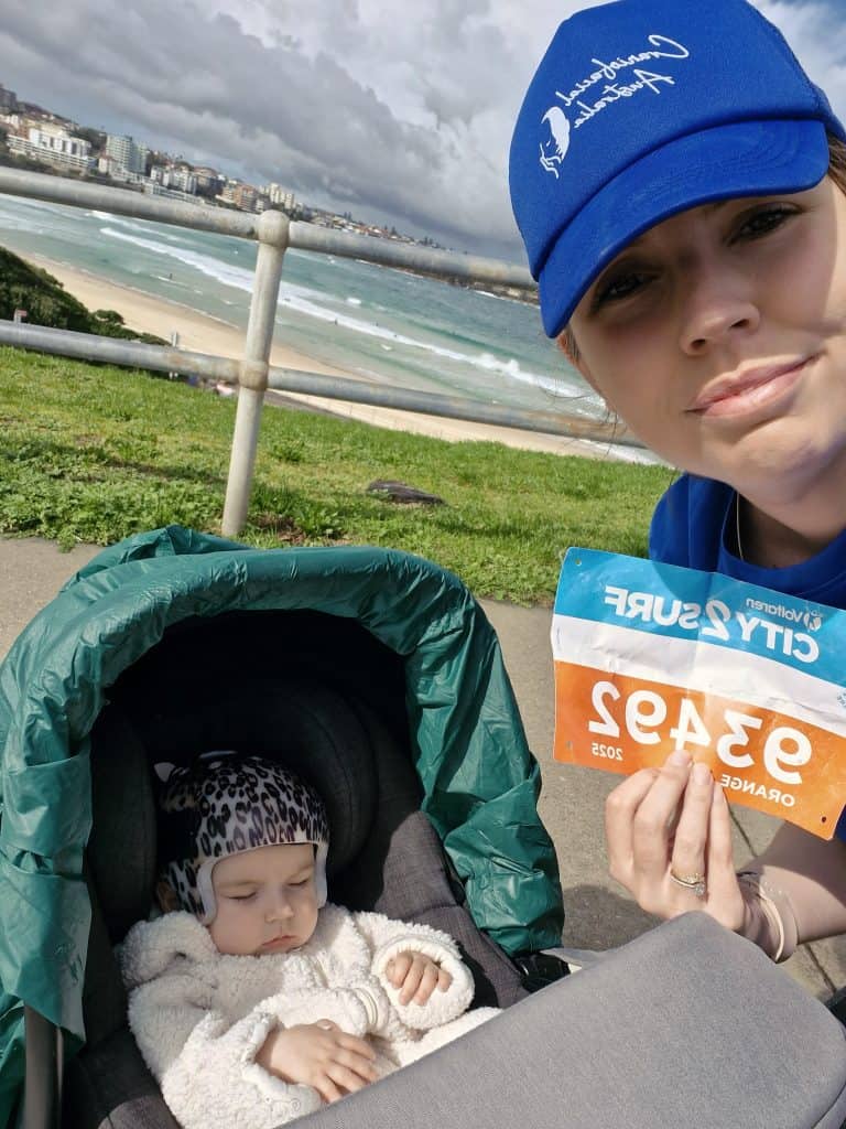 A child with craniofacial condition holding a fundraising badge at the beach.