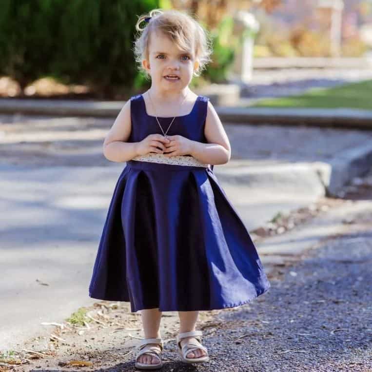 Young child with Apert syndrome