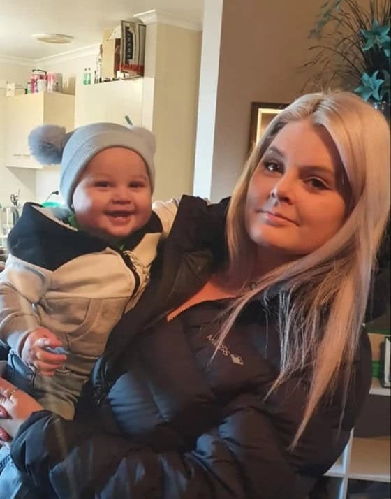 Mother with craniosynostosis holding her child