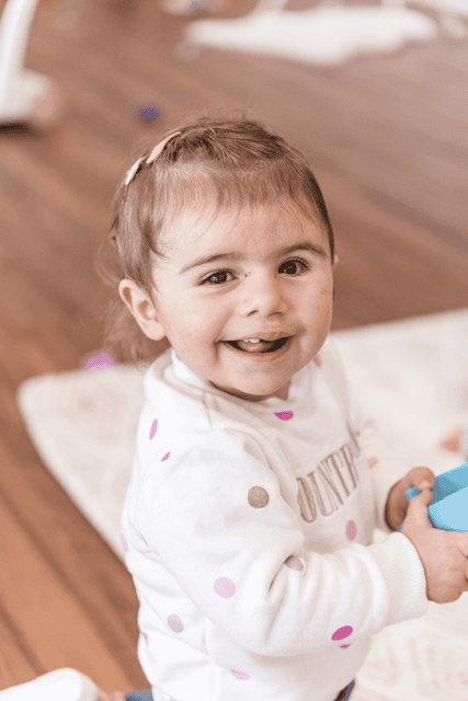 Little girl with unicoronal synostosis and unilateral cleft lip
