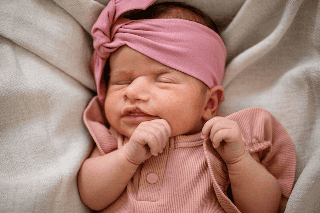 Baby with unicoronal synostosis and unilateral cleft lip