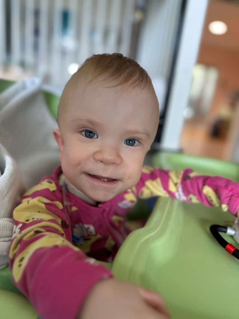 Little girl with sagittal synostosis