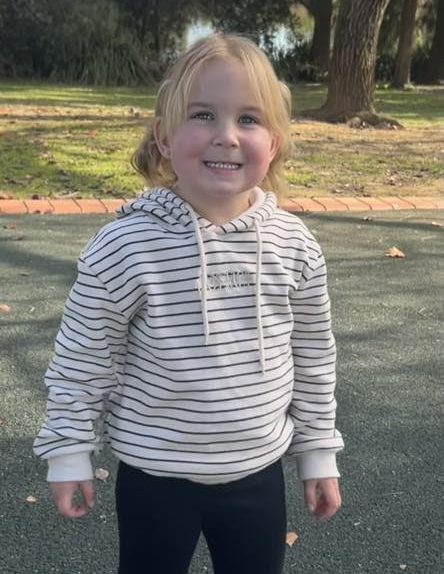Girl with sagittal synostosis in a striped hoodie outdoors in a park.