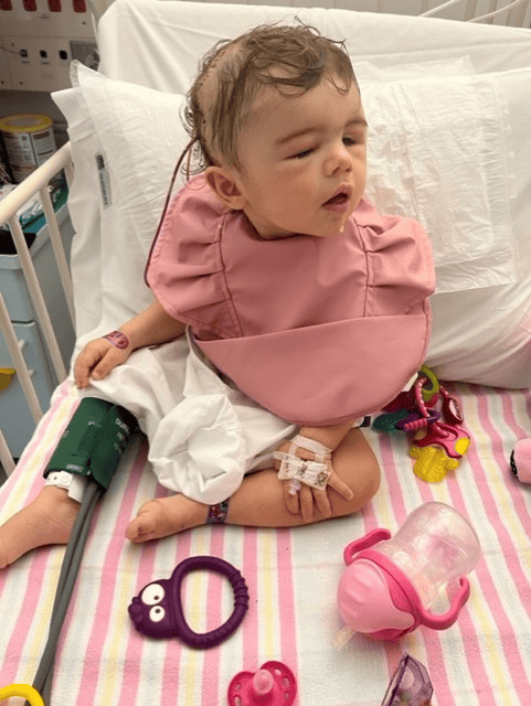 Little girl with unicoronal synostosis and unilateral cleft lip recovering following surgery