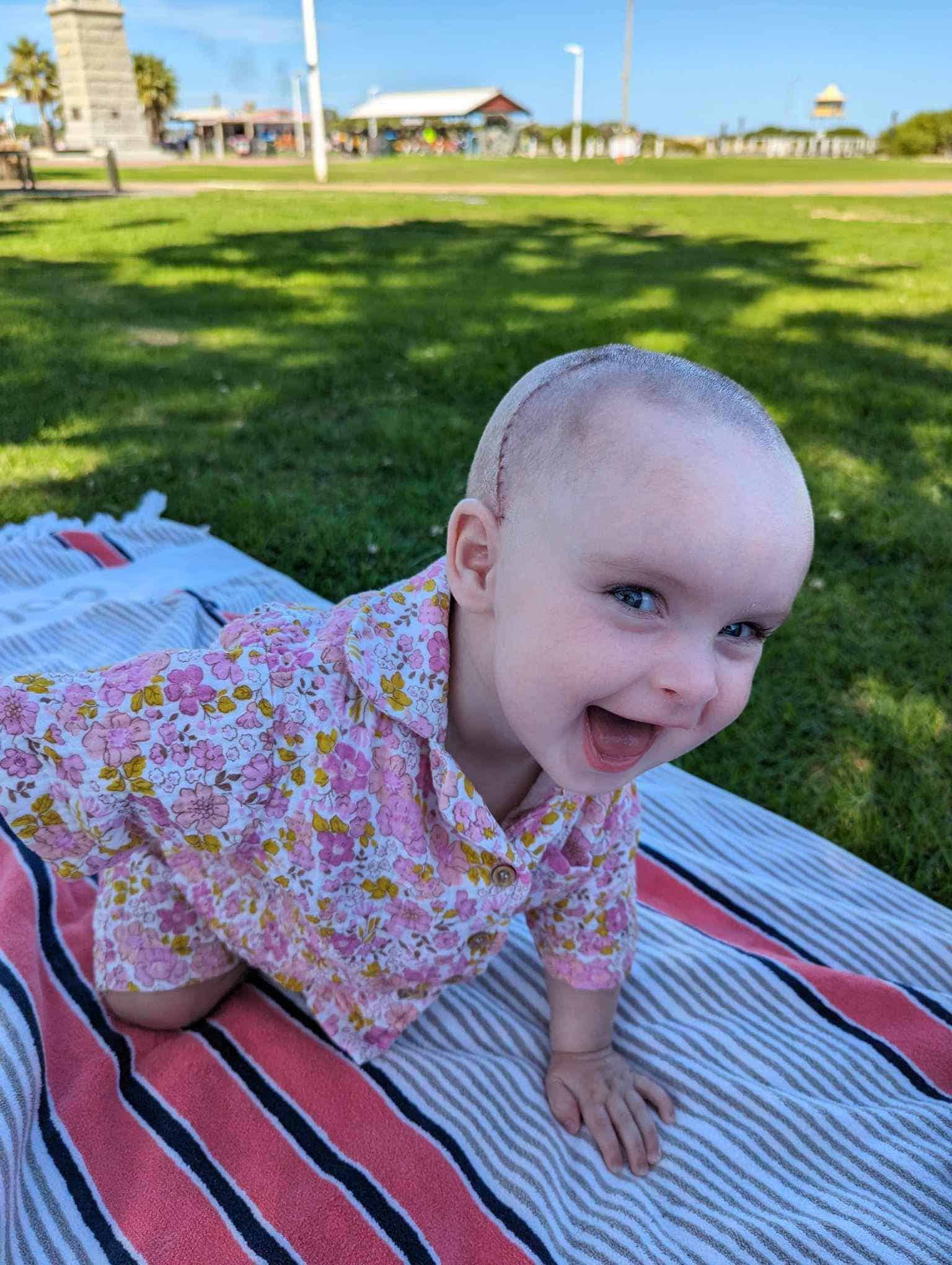 Little girl with sagittal synostosis crawling on a picnic blanket outdoors