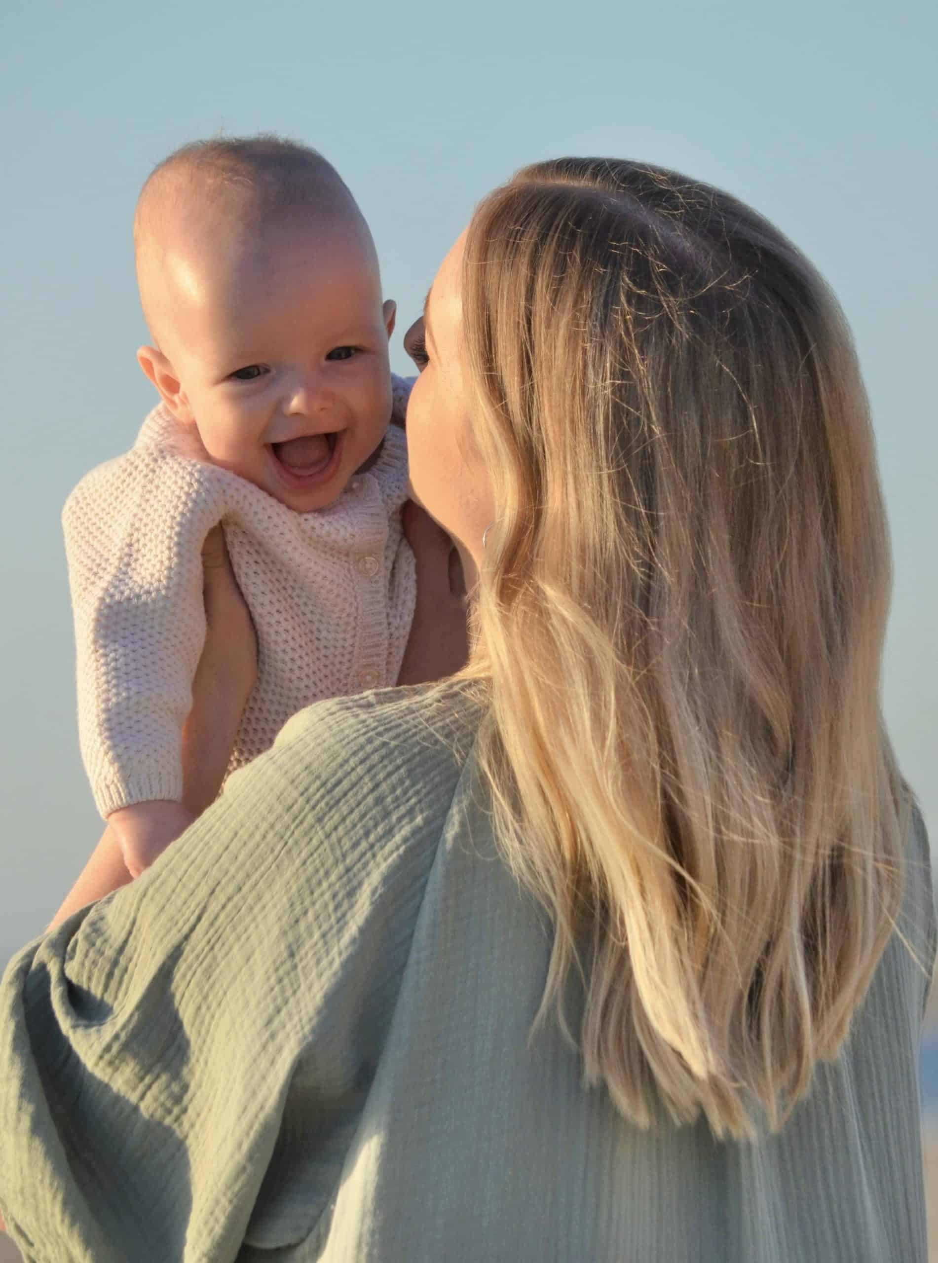 Baby boy with sagittal synostosis held by mother at the beach