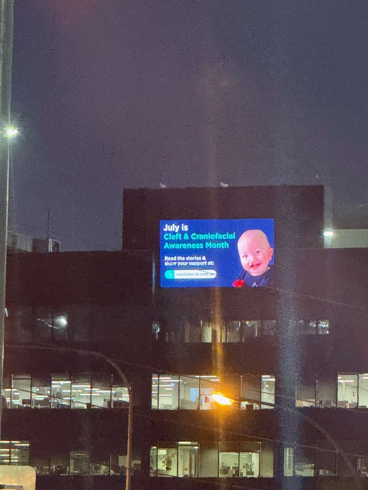 SA Power Networks billboard showing promotion for Cleft & Craniofacial Awareness Month in 2025, with photo of baby with cleft lip and palate and metopic synostosis