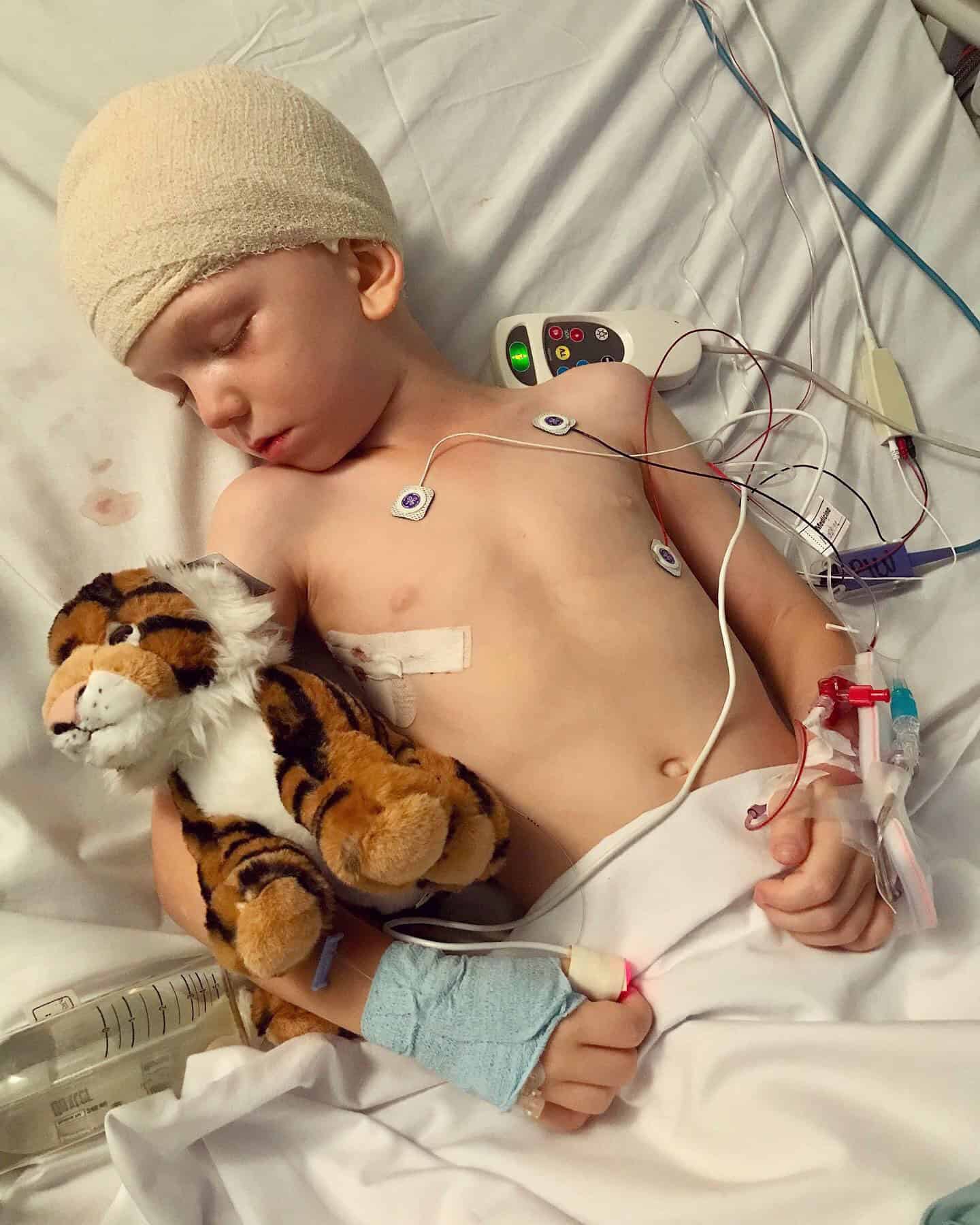 Boy with sagittal synostosis lying in hospital bed with bandage on head recovering from craniofacial surgery