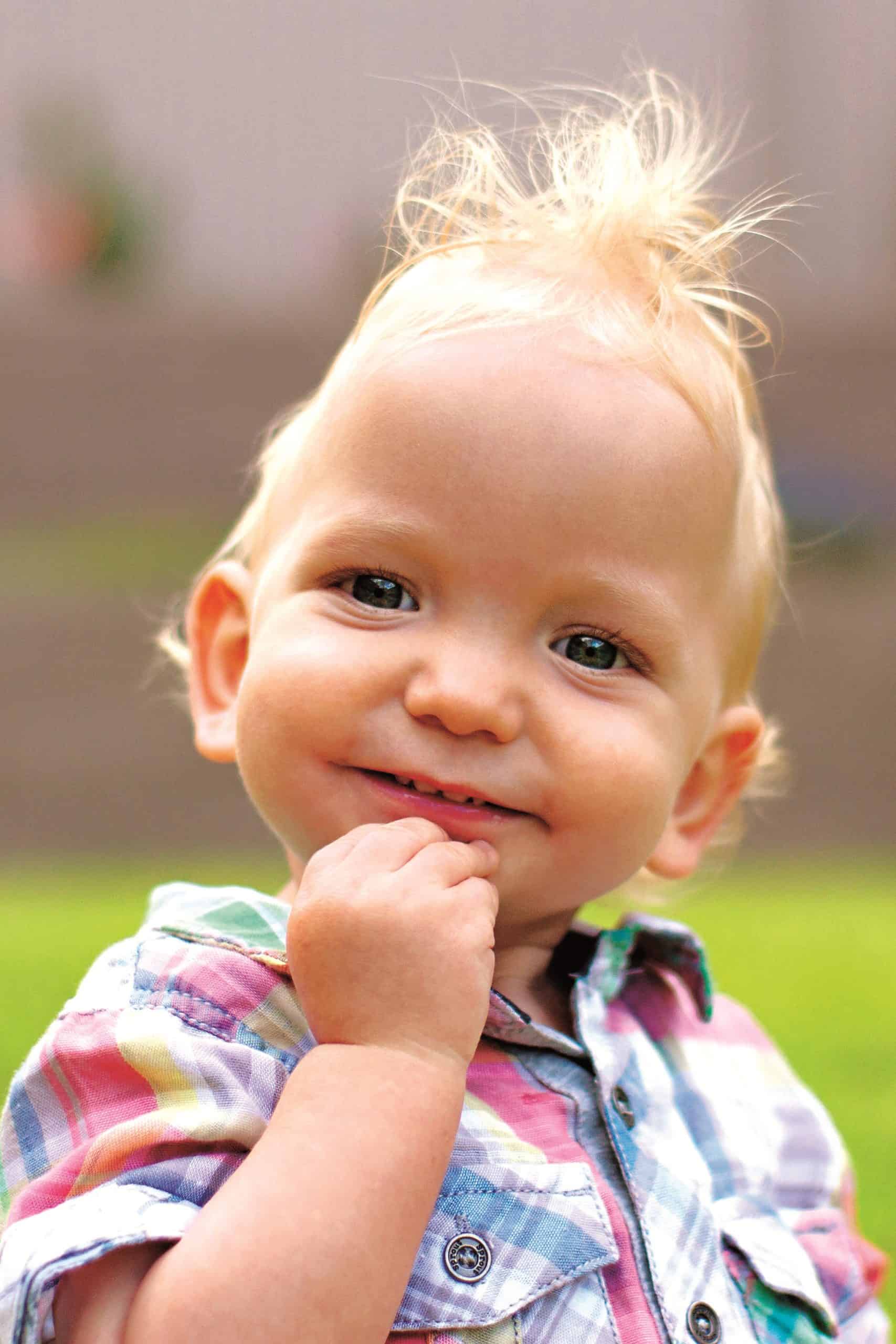 Baby boy with sagittal synostosis before surgery