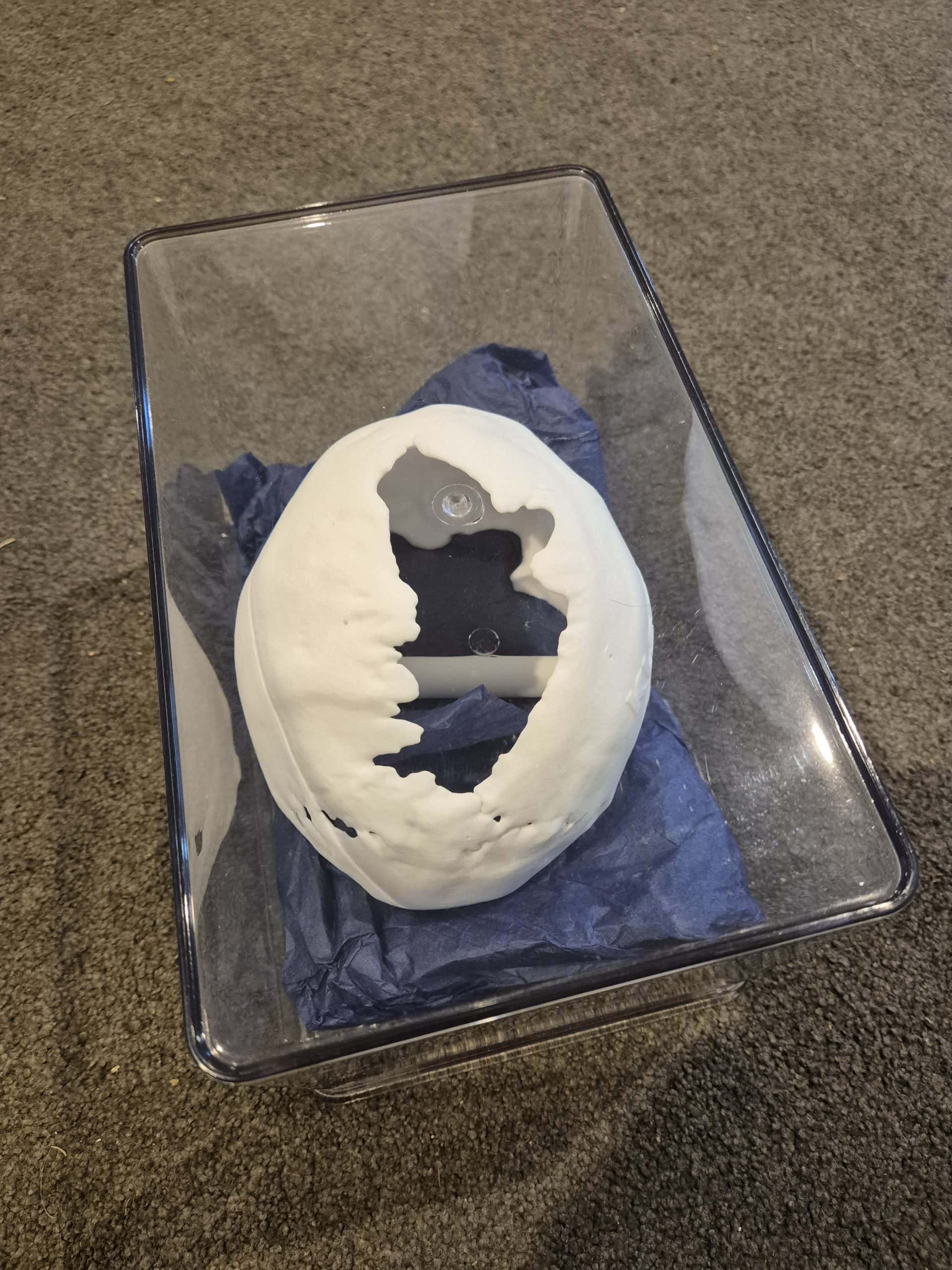 3D printed skull model of a baby with sagittal synostosis
