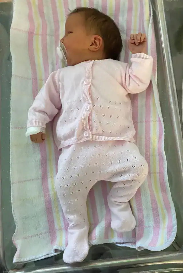Baby with sagittal synostosis