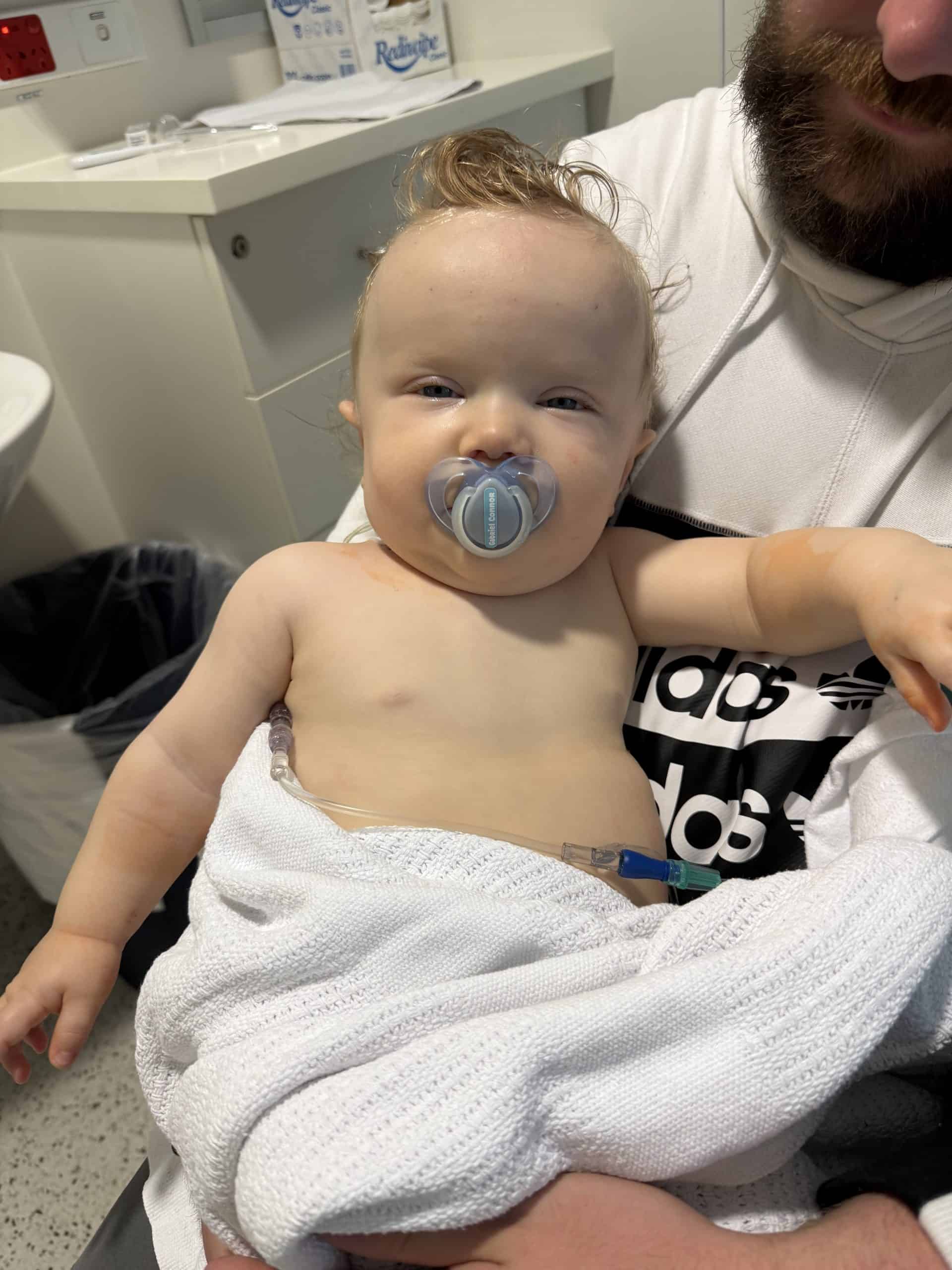 Baby with sagittal synostosis held by his father.
