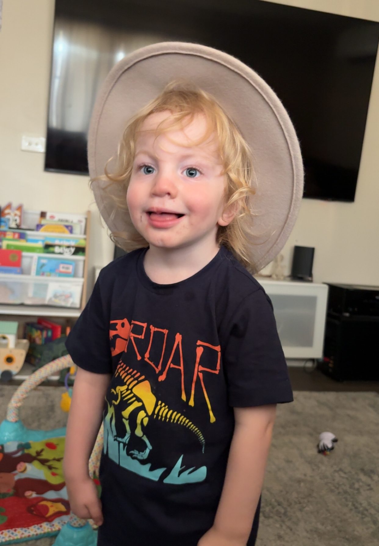 Boy with cleft lip and palate and metopic synostosis