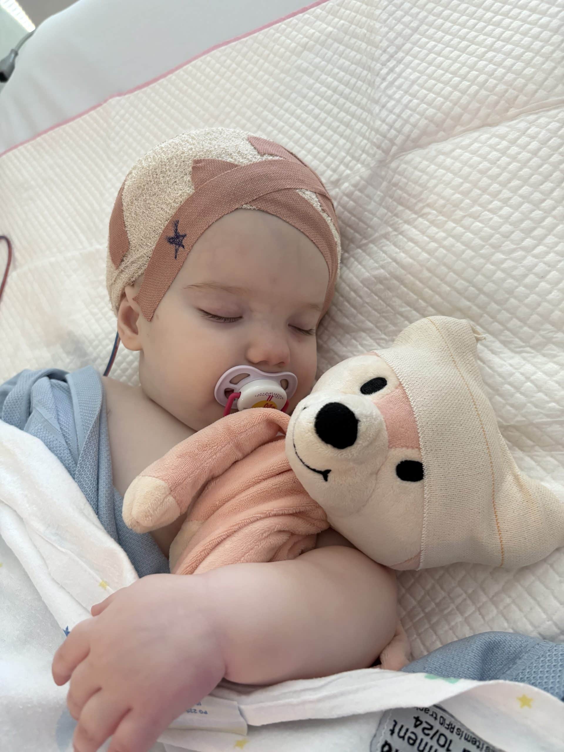 Baby with sagittal synostosis with bandages on head following craniofacial surgery, lying in bed holding a teddy bear