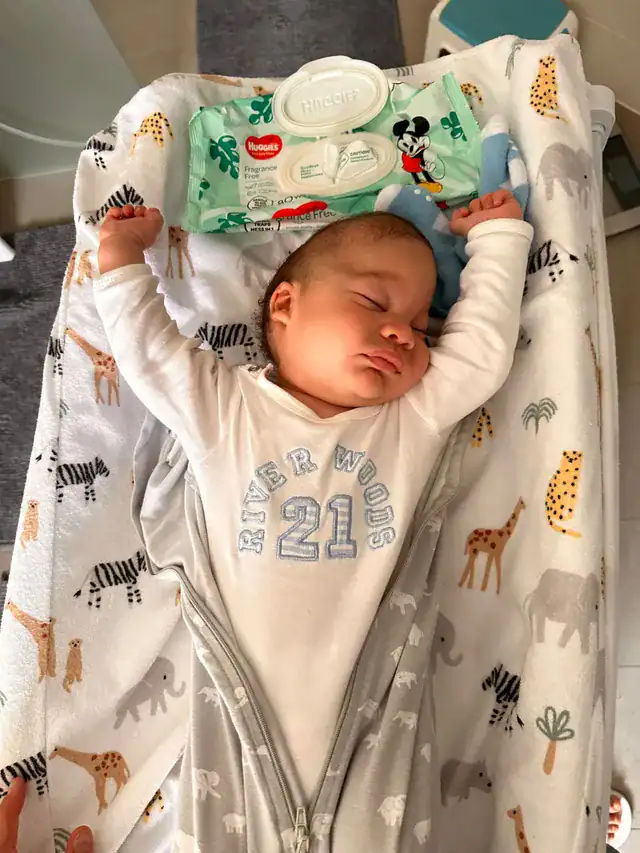 Baby boy with metopic synostosis