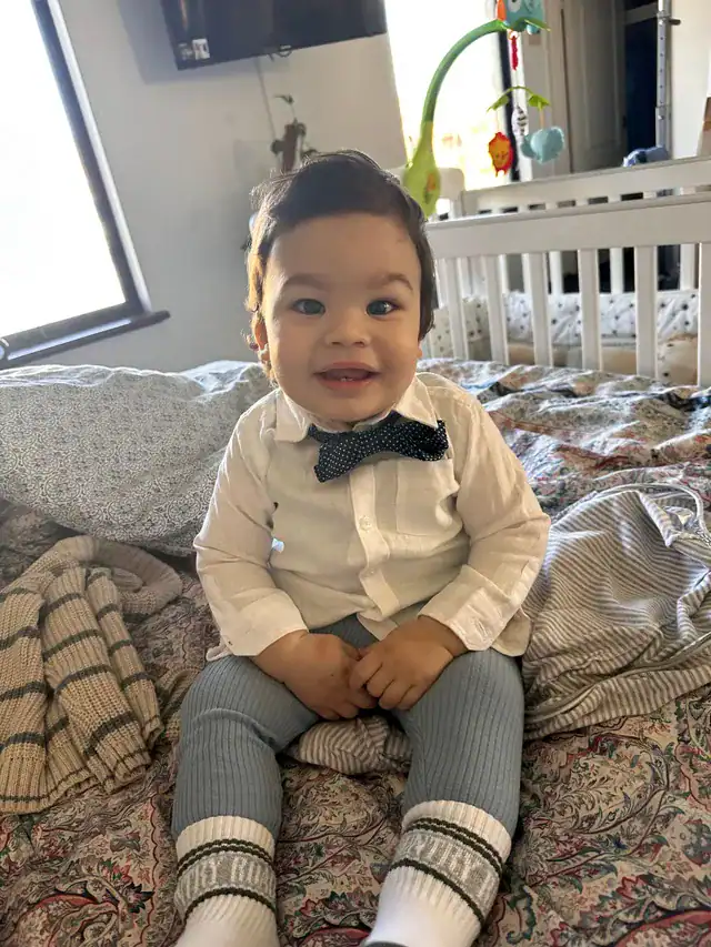 Little boy with metopic synostosis after recovering from surgery
