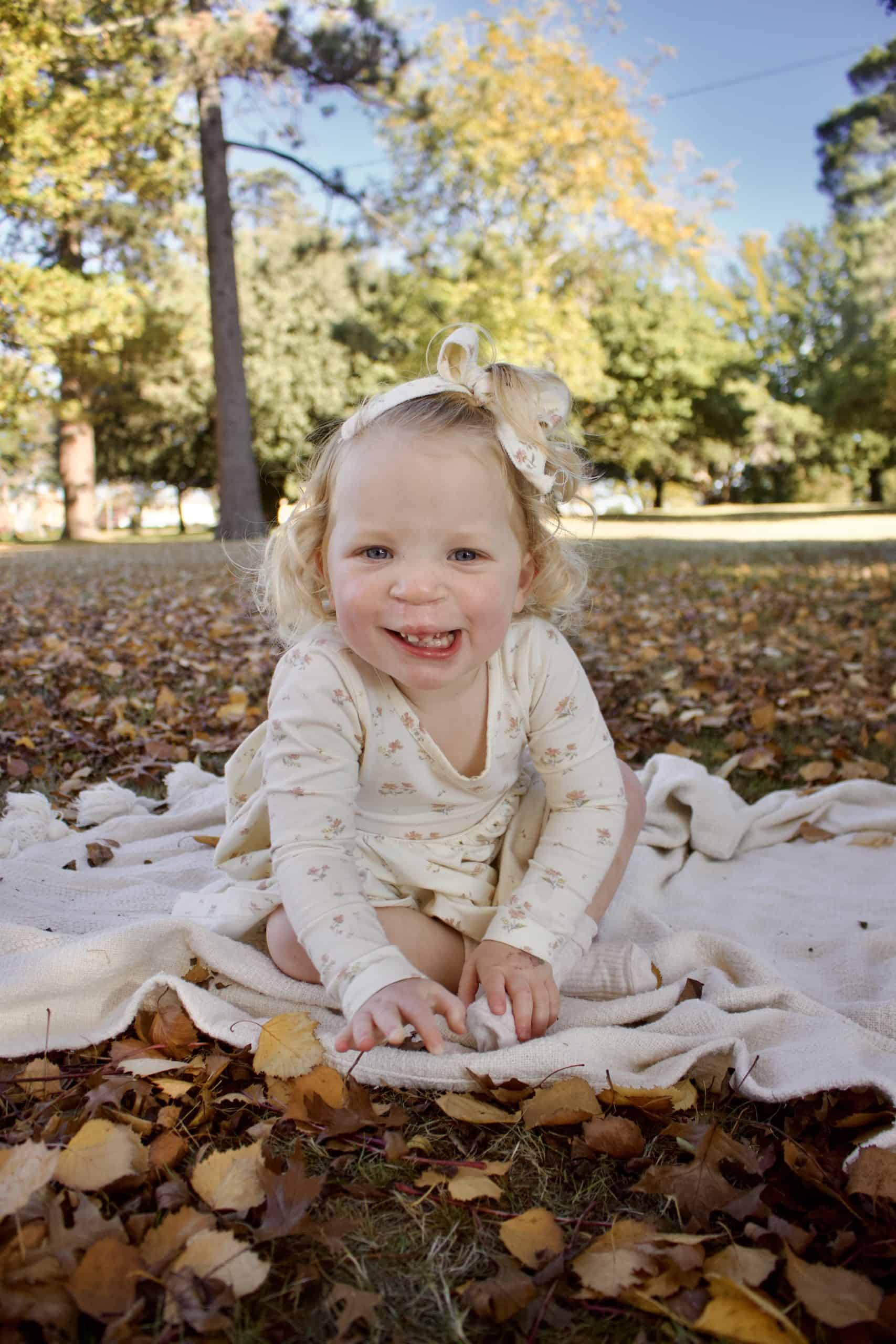 Little girl with cleft lip and palate post-surgery
