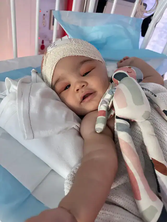 Baby boy with metopic synostosis lying in hospital cot with bandage on head following craniofacial surgery