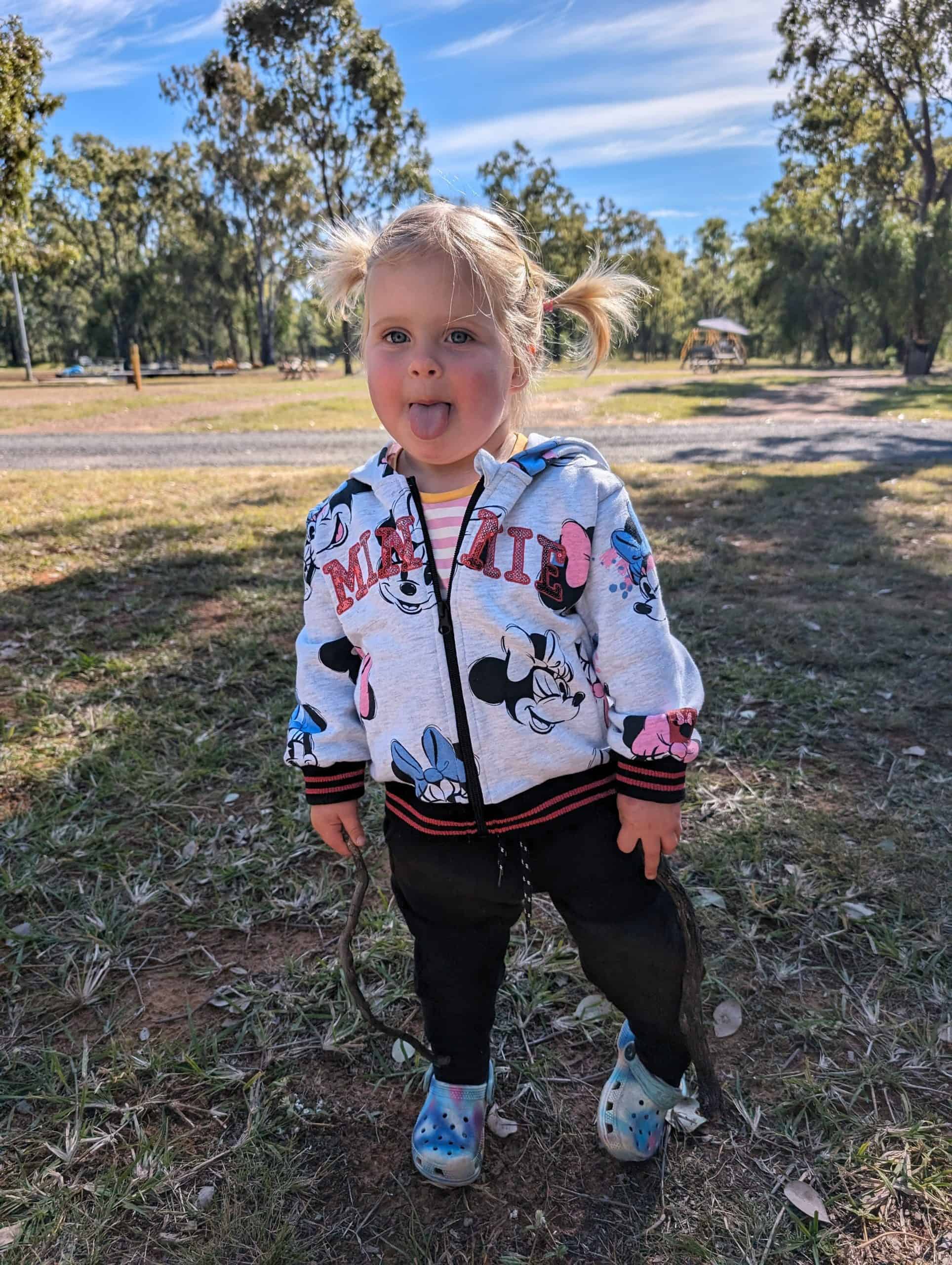 Little girl with sagittal synostosis post surgery standing outside