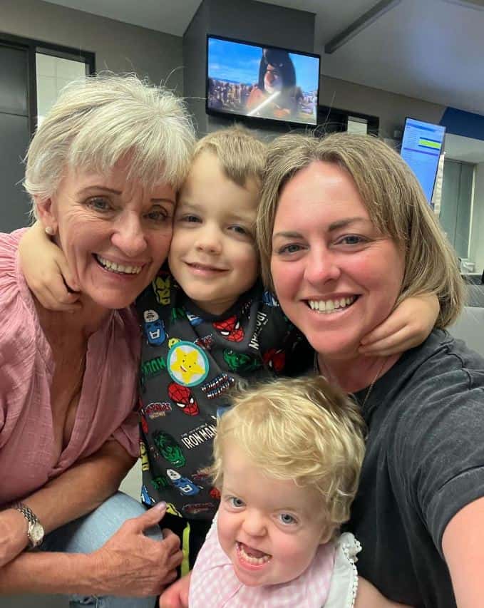 Little girl with Apert syndrome surrounded by her family