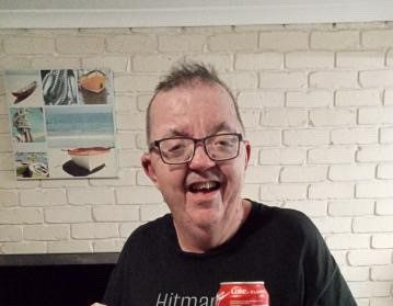 Man with Apert syndrome