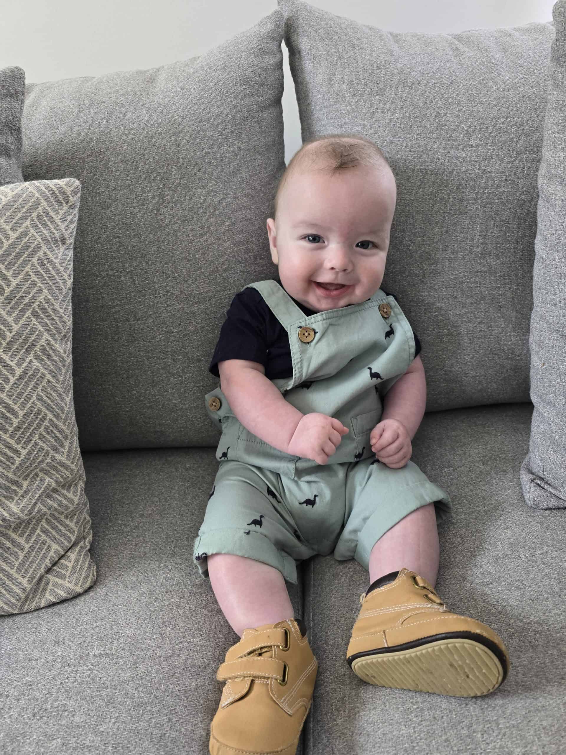 Baby with sagittal synostosis after undergoing helmet therapy, sitting on a sofa.