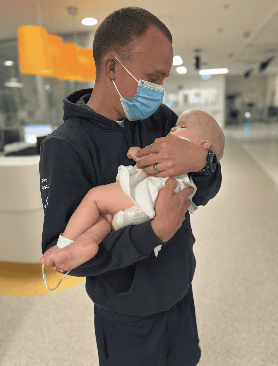 Baby with sagittal synostosis held by her father, who is standing in a hospital reception area.