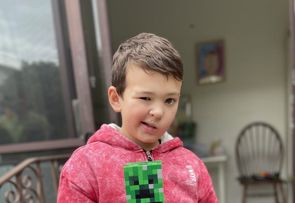 Boy who underwent surgery for a brain tumour and is undergoing facial reanimation therapy, holding a Minecraft Creeper toy