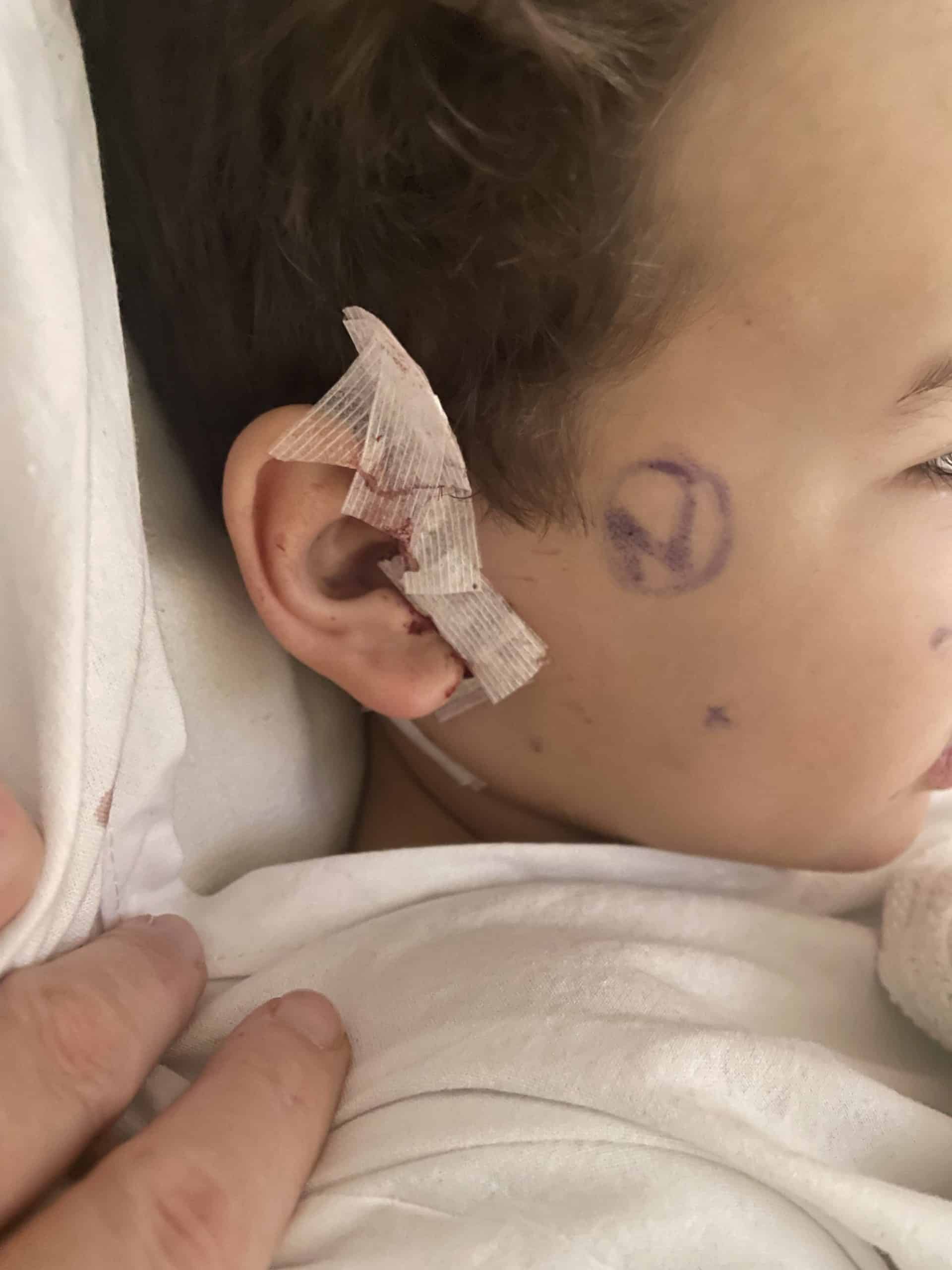 Profile view of face of boy in hospital undergoing surgery for a brain tumour