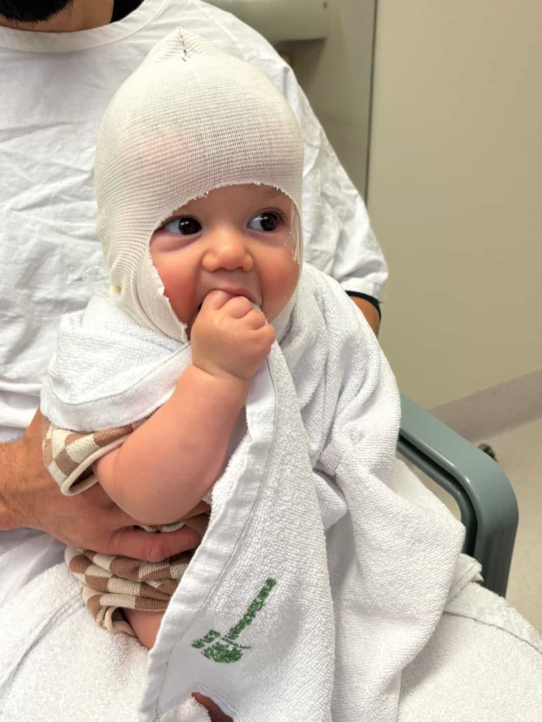 Baby with sagittal synostosis in hospital gown and head bandage.