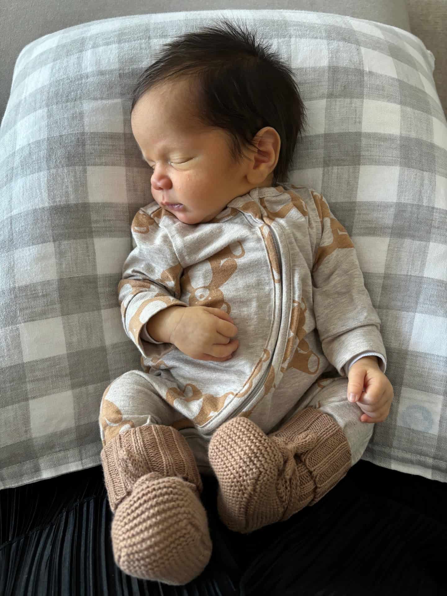 Newborn baby with sagittal synostosis.