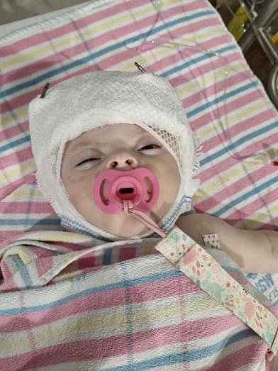Young child with craniofacial condition in hospital bed with medical headgear and pink pacifier.