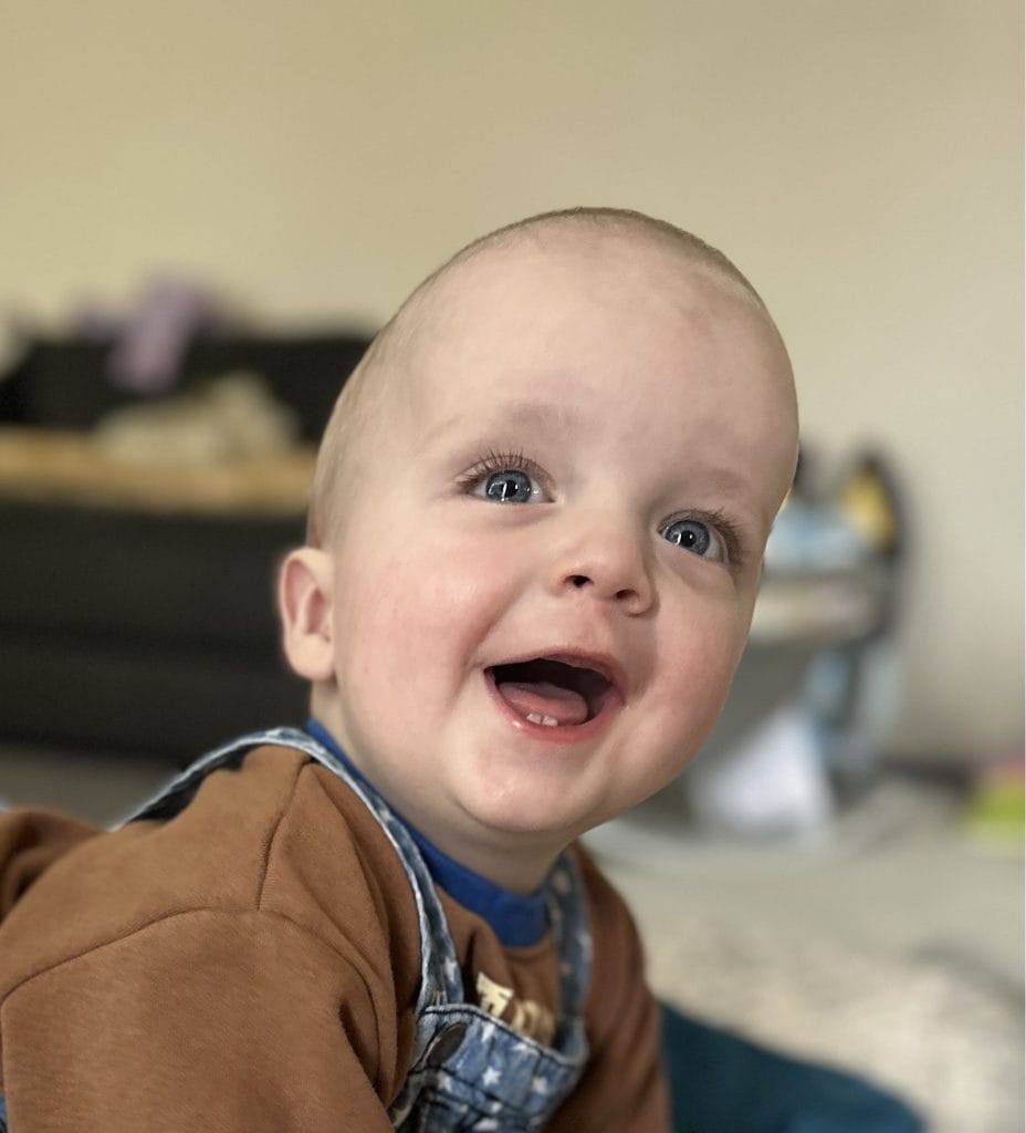 Happy young child with craniofacial condition smiling at home.