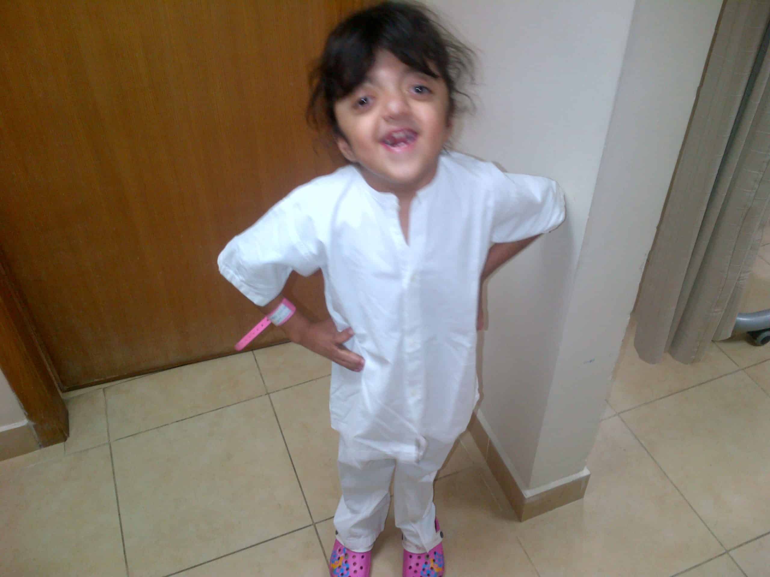 Young girl with craniofacial condition smiling in hospital gown at Craniofacial Australia.